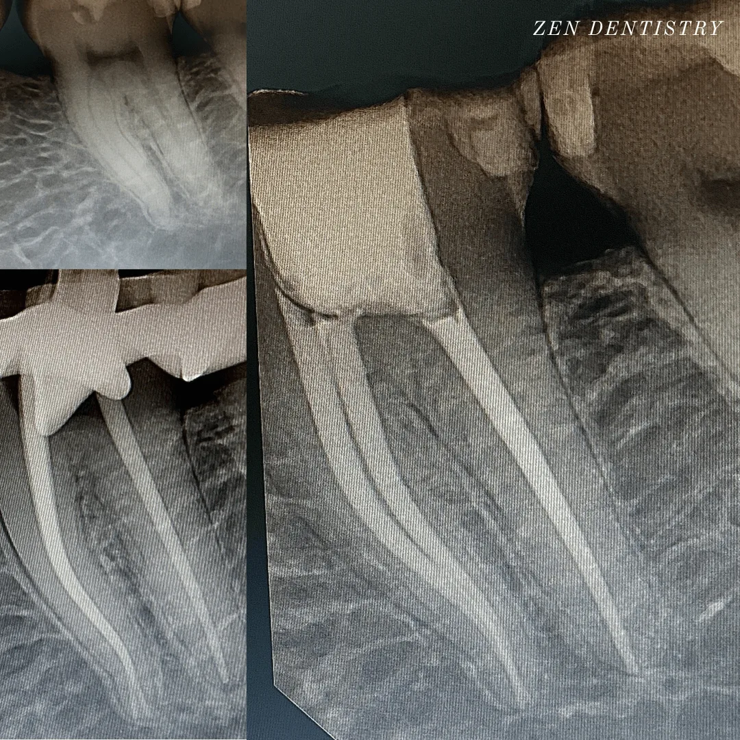 Before After 4 Before After 4