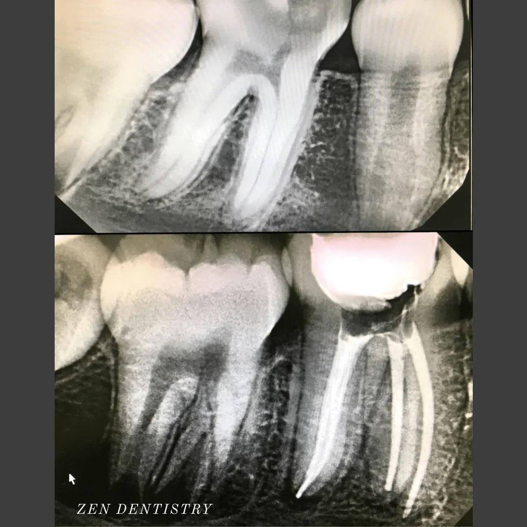 Before After 17 Before After 17