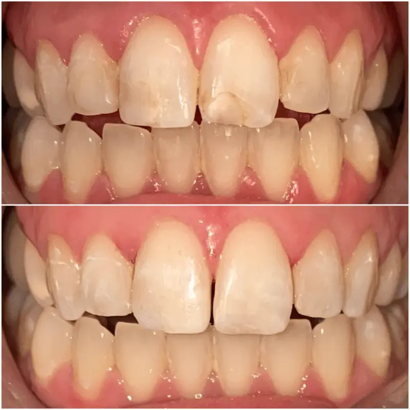 Before After 24 Before After 24